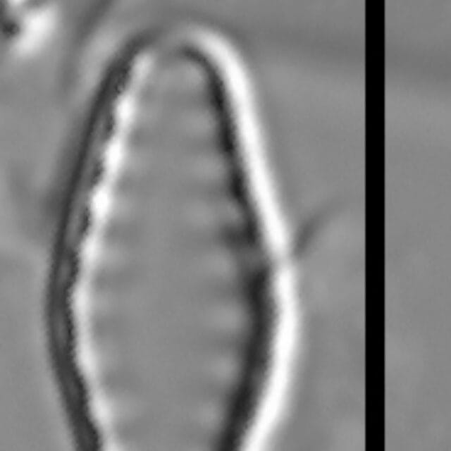 Pseudostaurosiropsis geocollegarum3 ILL L1433