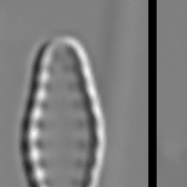 Pseudostaurosiropsis geocollegarum5 ILL L1433