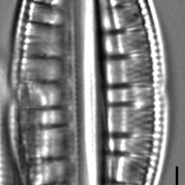 Rhopalodia gibberula LM3