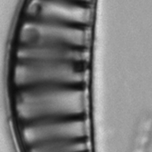 Rhopalodia gibberula LM1