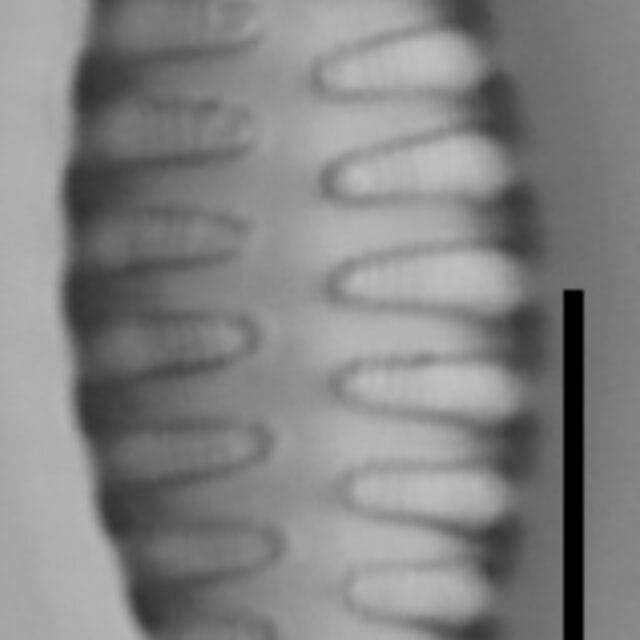 Staurosirella martyi LM15