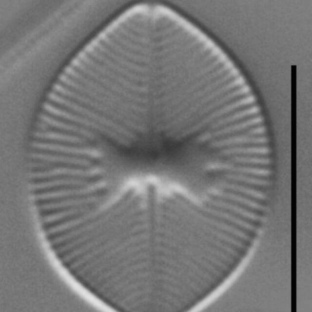 Skabitschewskia oestrupii LM7