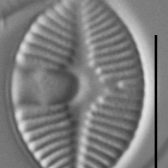 Skabitschewskia oestrupii LM5