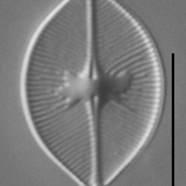 Skabitschewskia oestrupii LM3