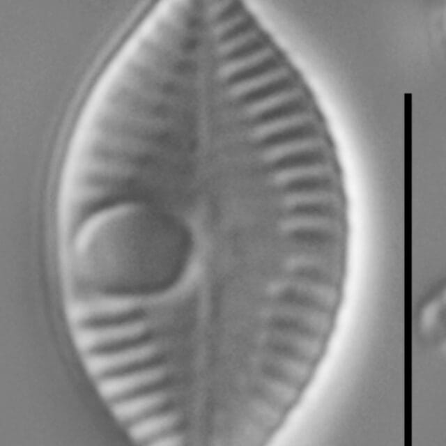 Skabitschewskia oestrupii LM6