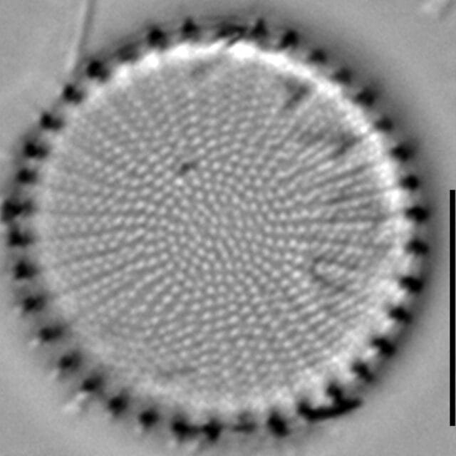 Stephanodiscus hantzschii LM3