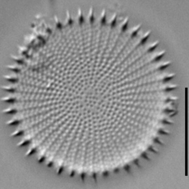 Stephanodiscus hantzschii LM7