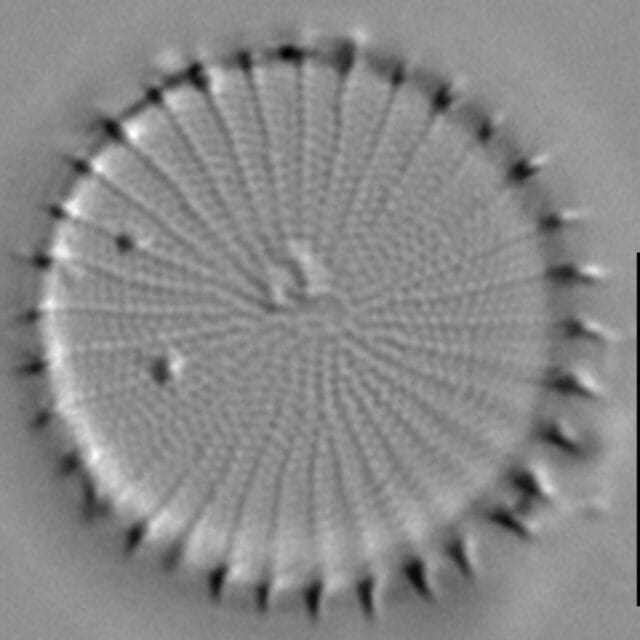 Stephanodiscus hantzschii f tenuis LM5