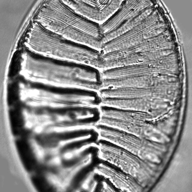 Surirella striatula LM7