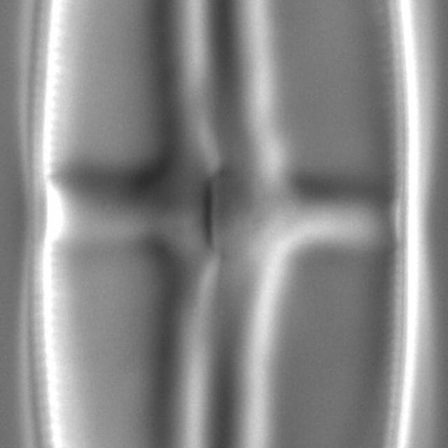 Stauroneis kishinena LM6