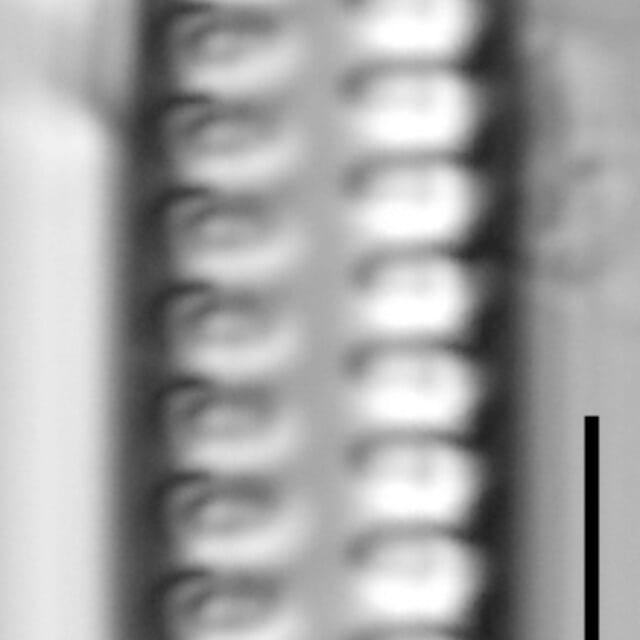 Staurosirella neopinnata LM4