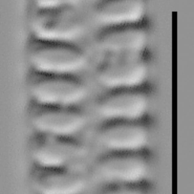 Staurosirella neopinnata LM5