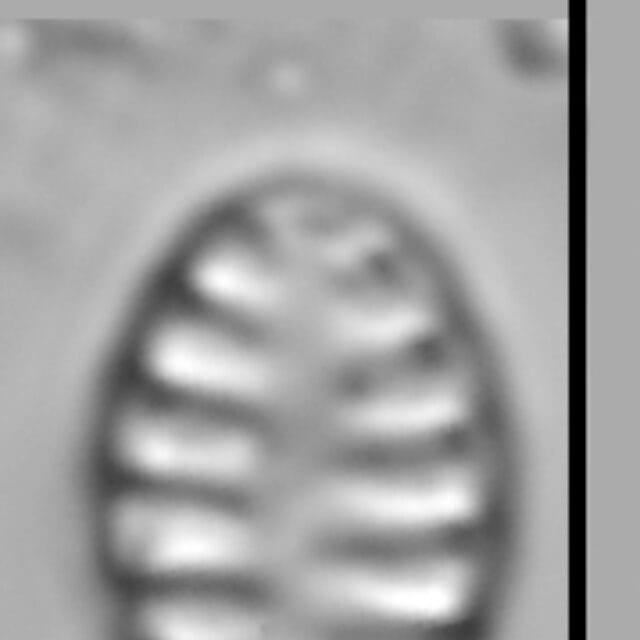 Staurosirella neopinnata LM7