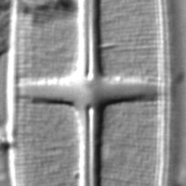 Stauroneis siberica LM6