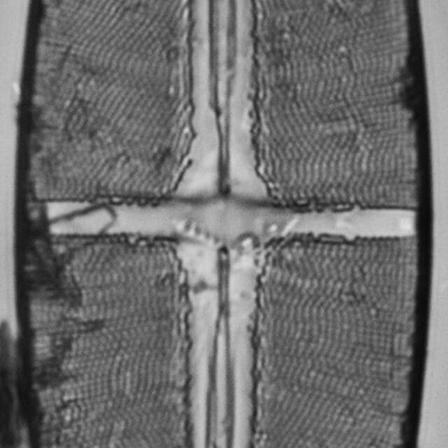 Stauroneisbaileyi ANSP GC49116a 6