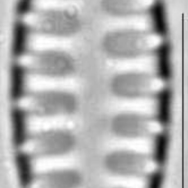 Staurosirella leptostauron var dubia LM1