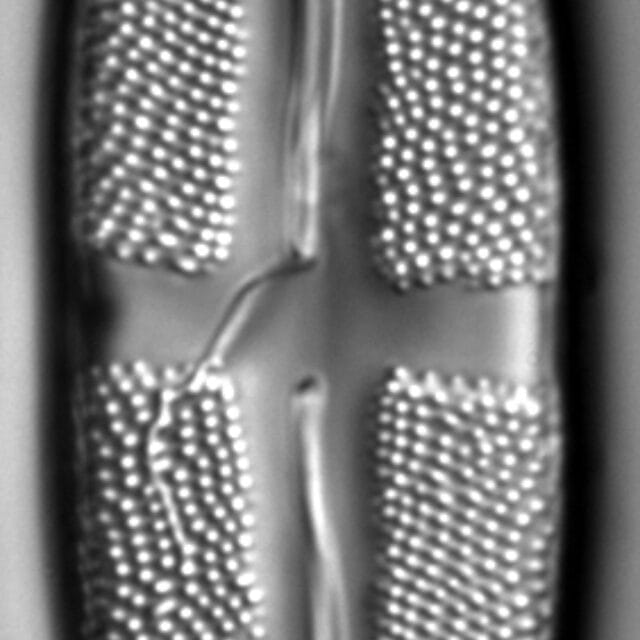 Stauroneis thompsonii LM5
