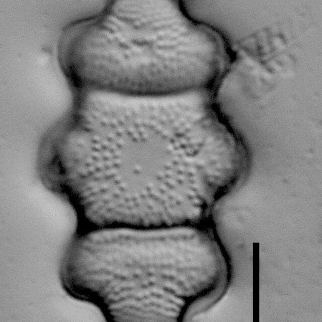 Stoermeria americana LM1