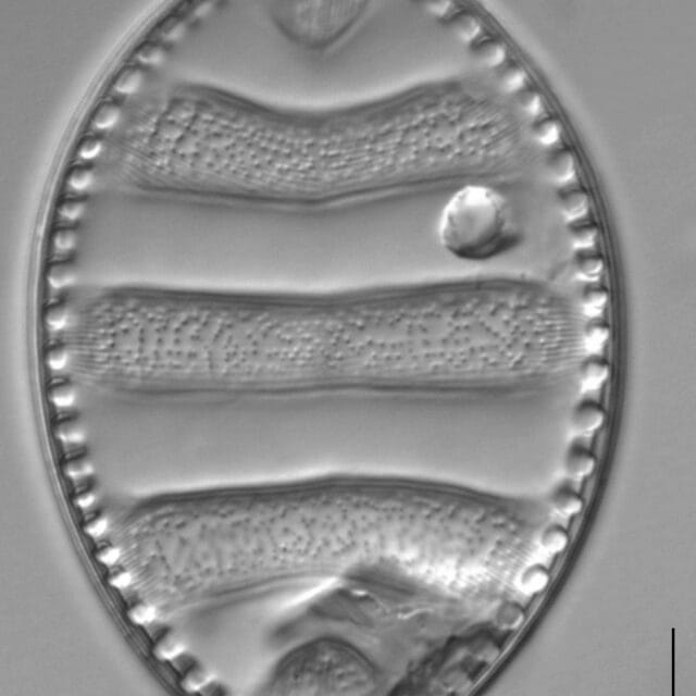 Surirella undulata LM5