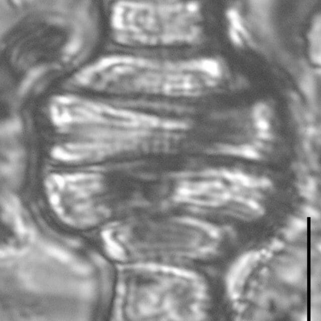 Tetracyclus emarginatus LM5
