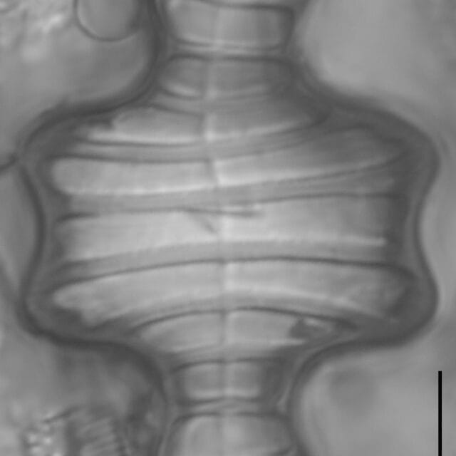 Tetracyclus emarginatus LM4