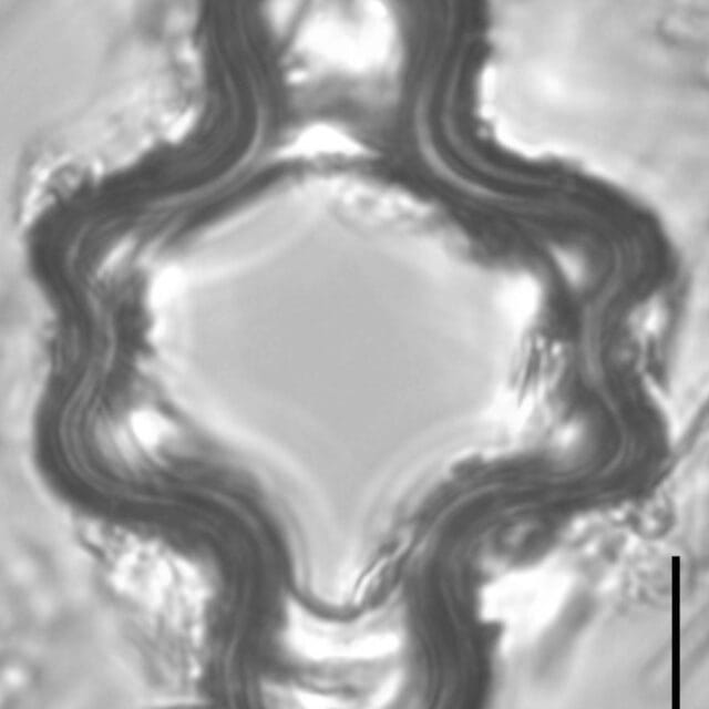 Tetracyclus emarginatus LM1