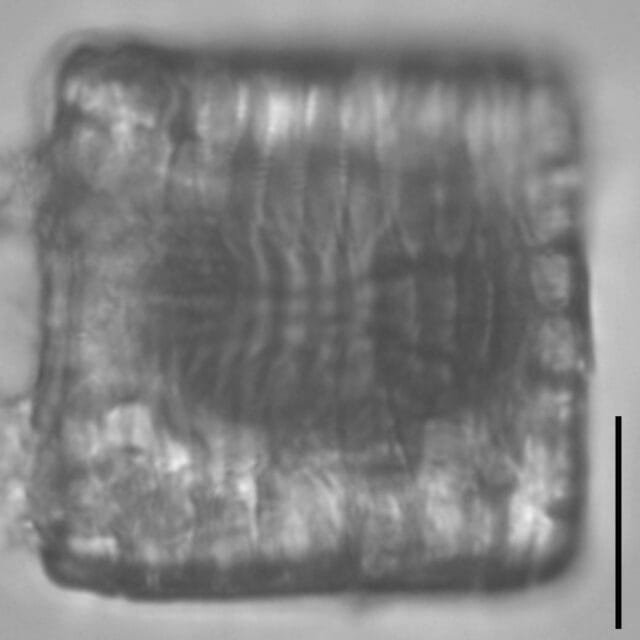 Tetracyclus emarginatus LM2