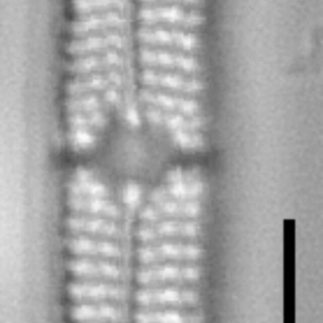 Tursiocola bondei LM2