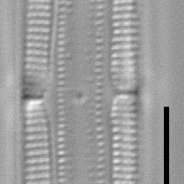 Tursiocola bondei LM4