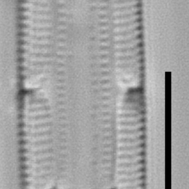 Tursiocola bondei LM5