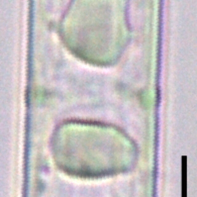 Tursiocola bondei LM6