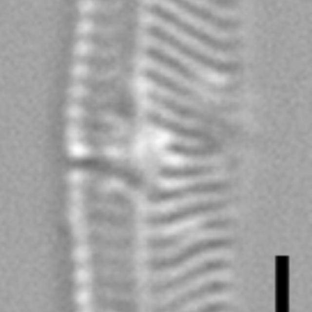 Tursiocola costata LM1 r