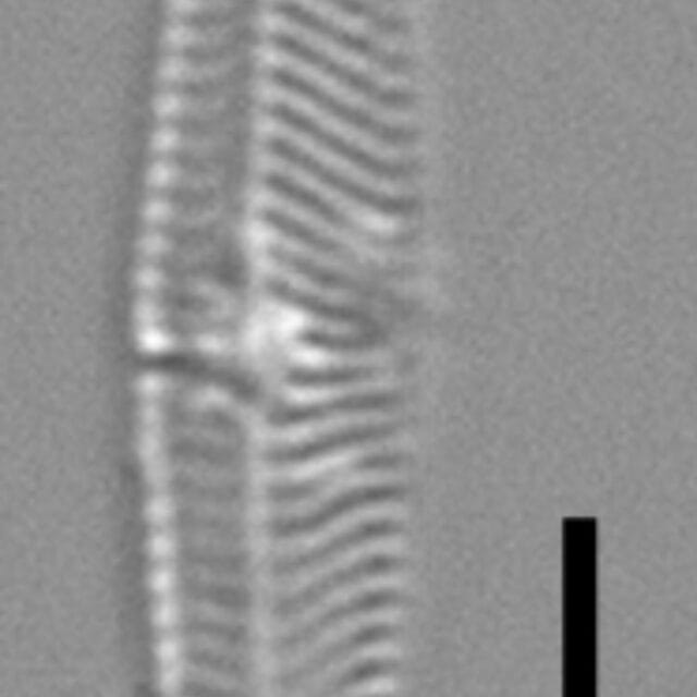 Tursiocola costata LM1