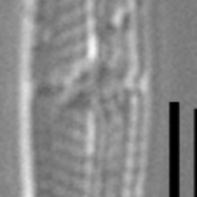 Tursiocola costata LM2 r