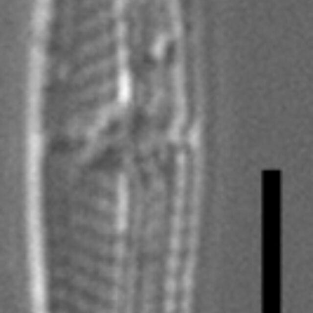 Tursiocola costata LM2