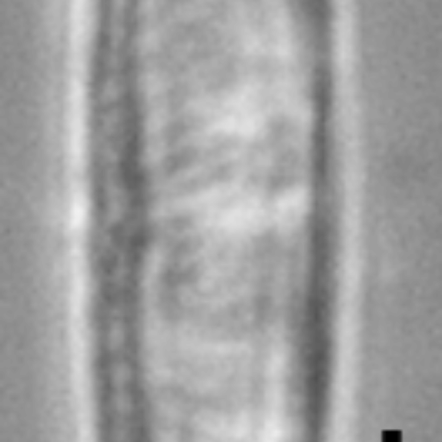 Tursiocola costata LM3 r