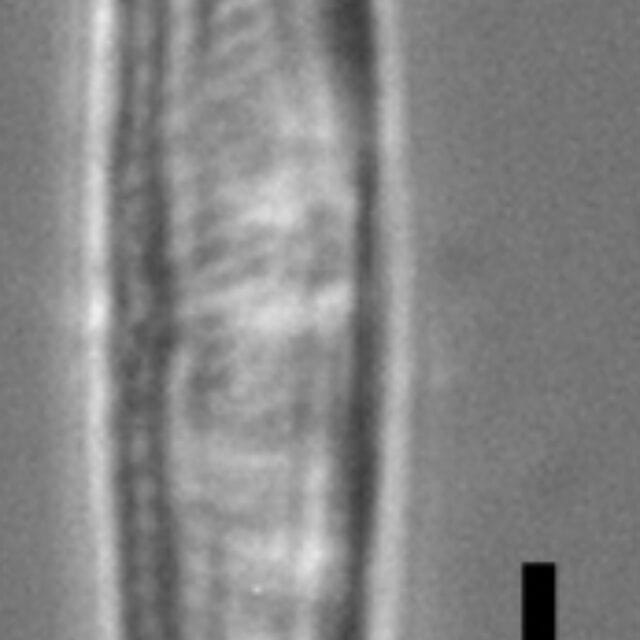 Tursiocola costata LM3