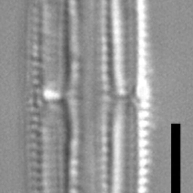 Tursiocola costata LM4