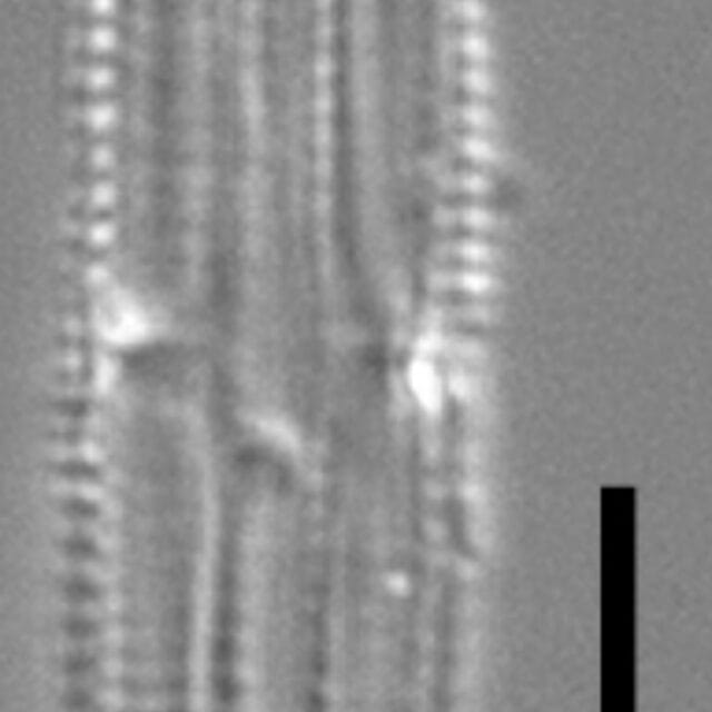 Tursiocola costata LM5