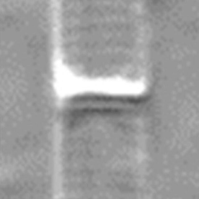 Tursiocola cymbelloides LM1