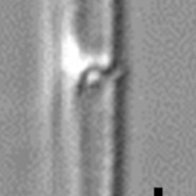 Tursiocola cymbelloides LM2