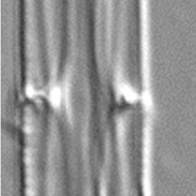 Tursiocola cymbelloides LM3