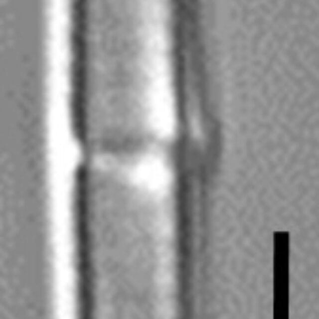 Tursiocola cymbelloides LM4