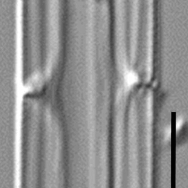 Tursiocola cymbelloides LM5