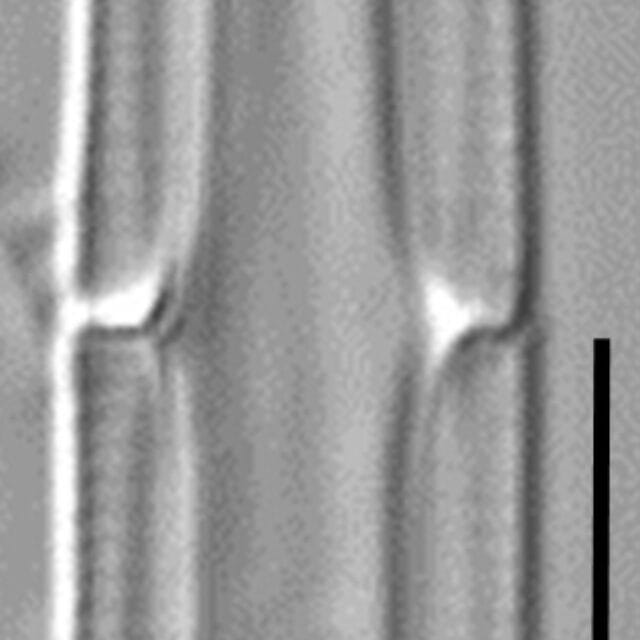Tursiocola cymbelloides LM6