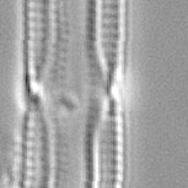 Tursiocola gracilis LM5