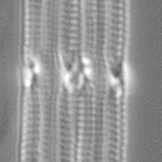 Tursiocola gracilis LM7