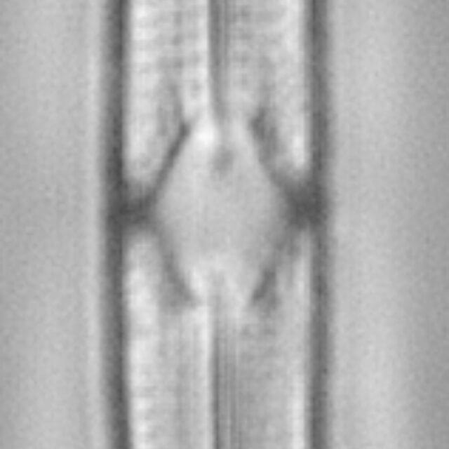 Tursiocola varicopulifera LM1