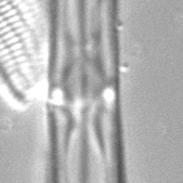 Tursiocola varicopulifera LM2