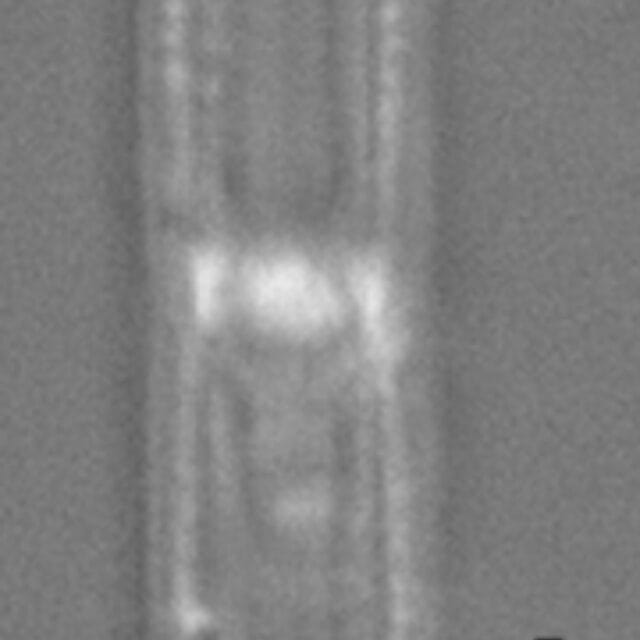 Tursiocola varicopulifera LM4